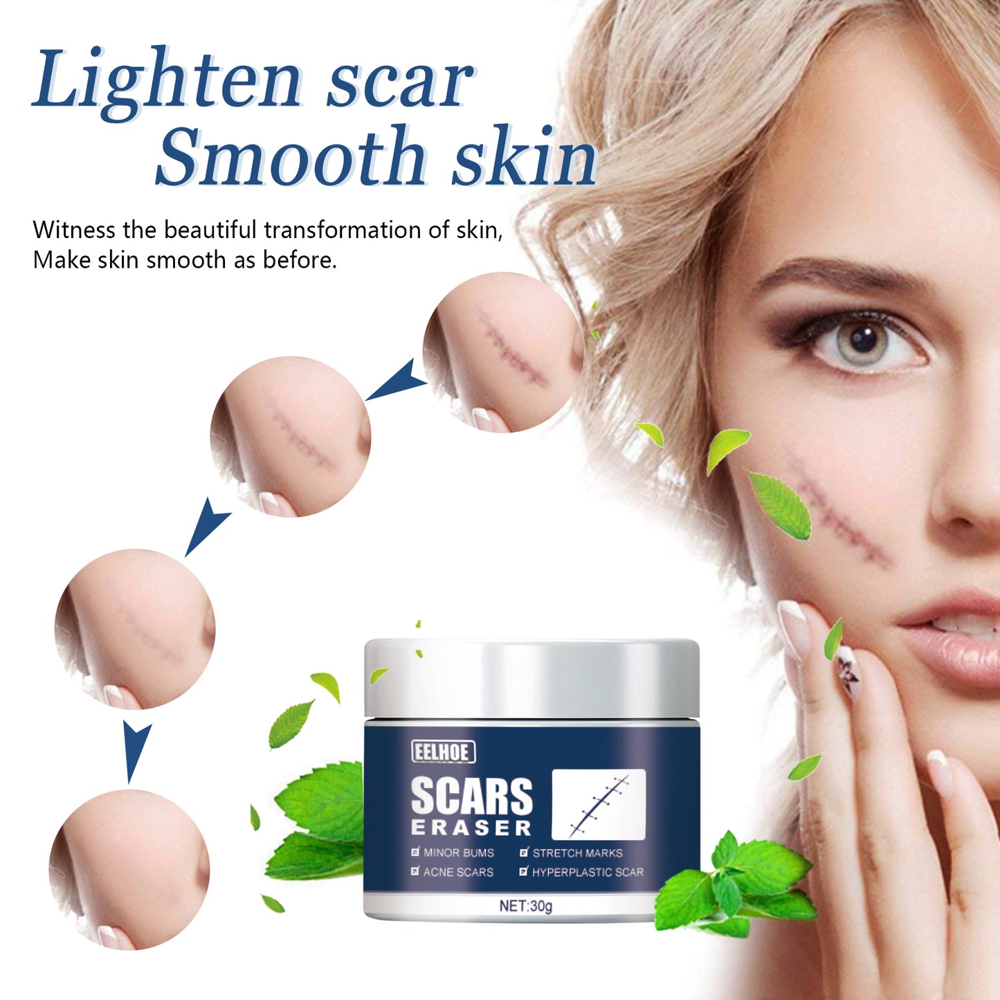 EELHOE Scar Balm, Scar Repair, Cold Compress Gel Balm
