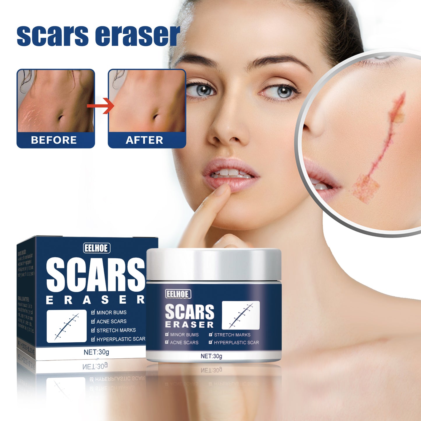 EELHOE Scar Balm, Scar Repair, Cold Compress Gel Balm