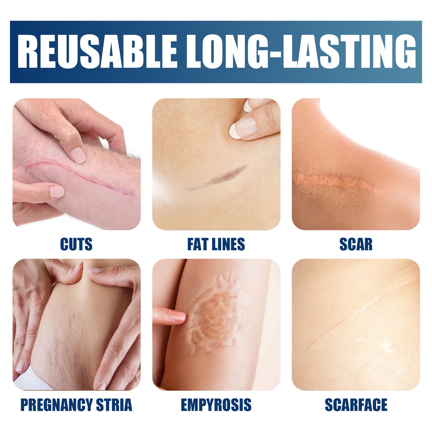 Scar Repair Gel, Repair and Moisturize Skin
