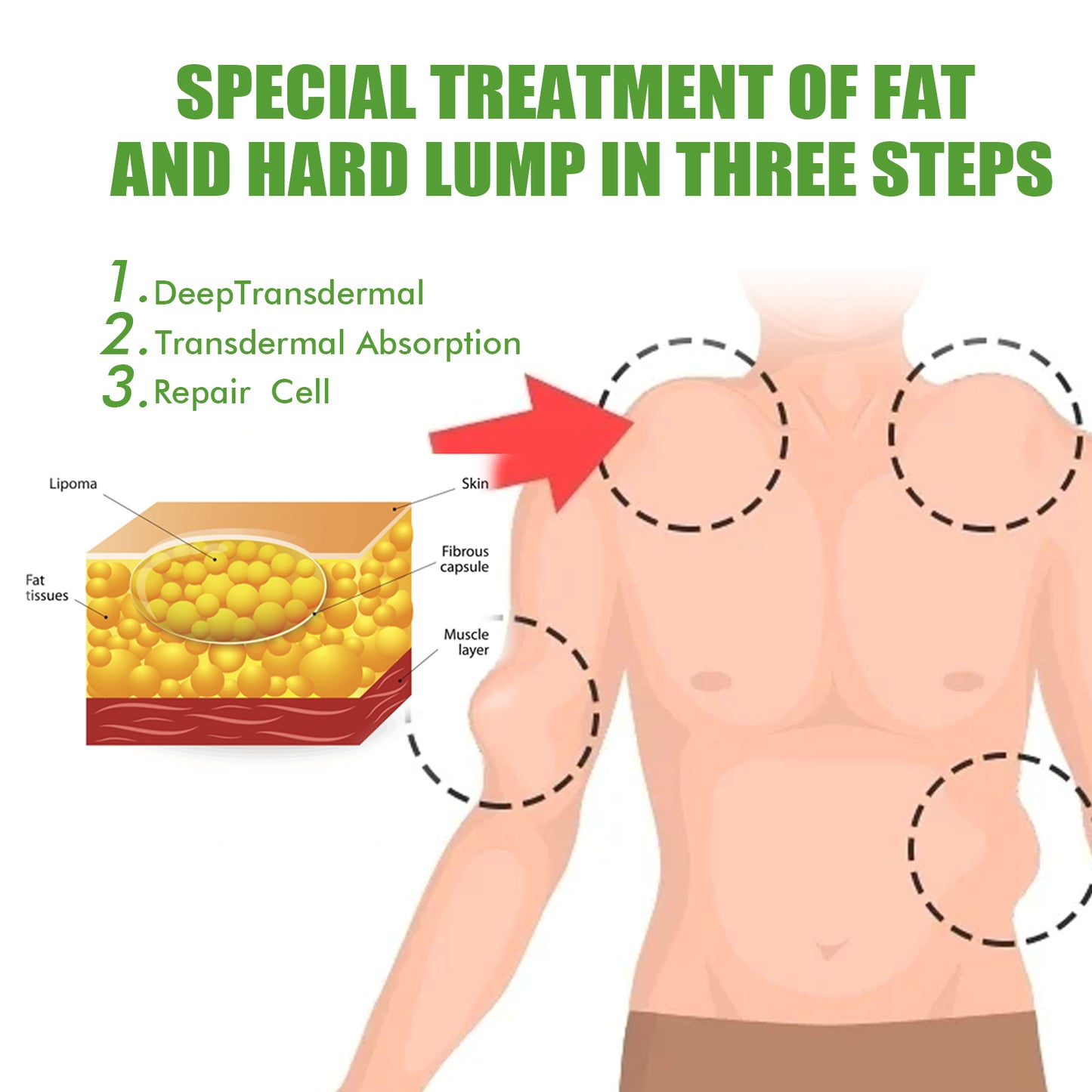 Fat Binding Cream, Dredge Body of Fatty Subcutaneous Lumps, Body Care Cream